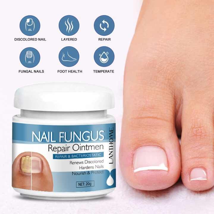 Nail Fungus Removal Cream